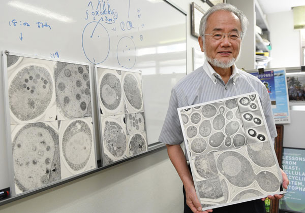 Il riciclaggio della cellula che si nutre di sé