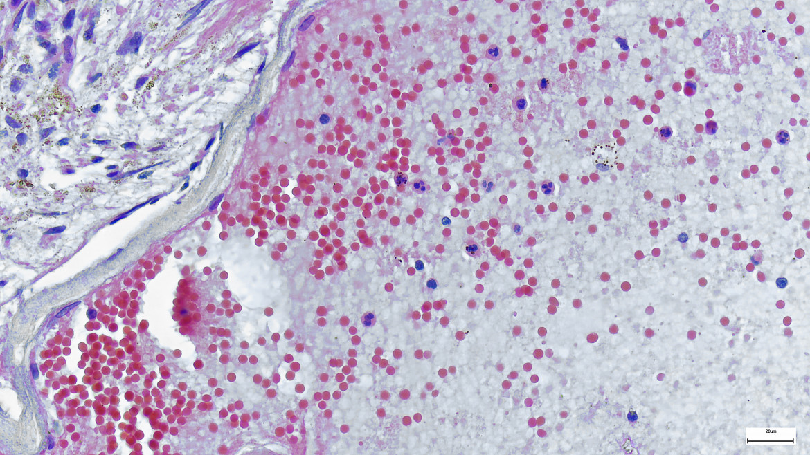 «Prevenire e controllare le invasioni biologiche è urgente e necessario»