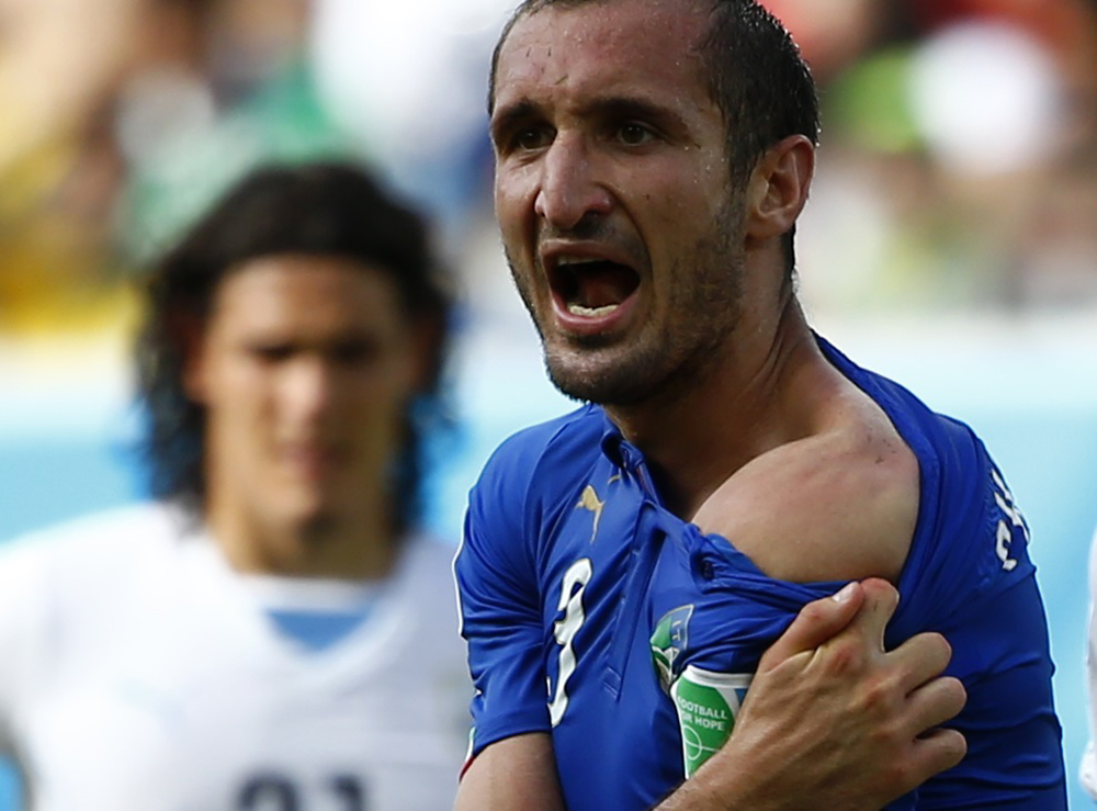 Italy’s Giorgio Chiellini shows his shoulder, claiming he was bitten by Uruguay’s Luis Suarez, during their 2014 World Cup Group D soccer match at the Dunas arena in Natal