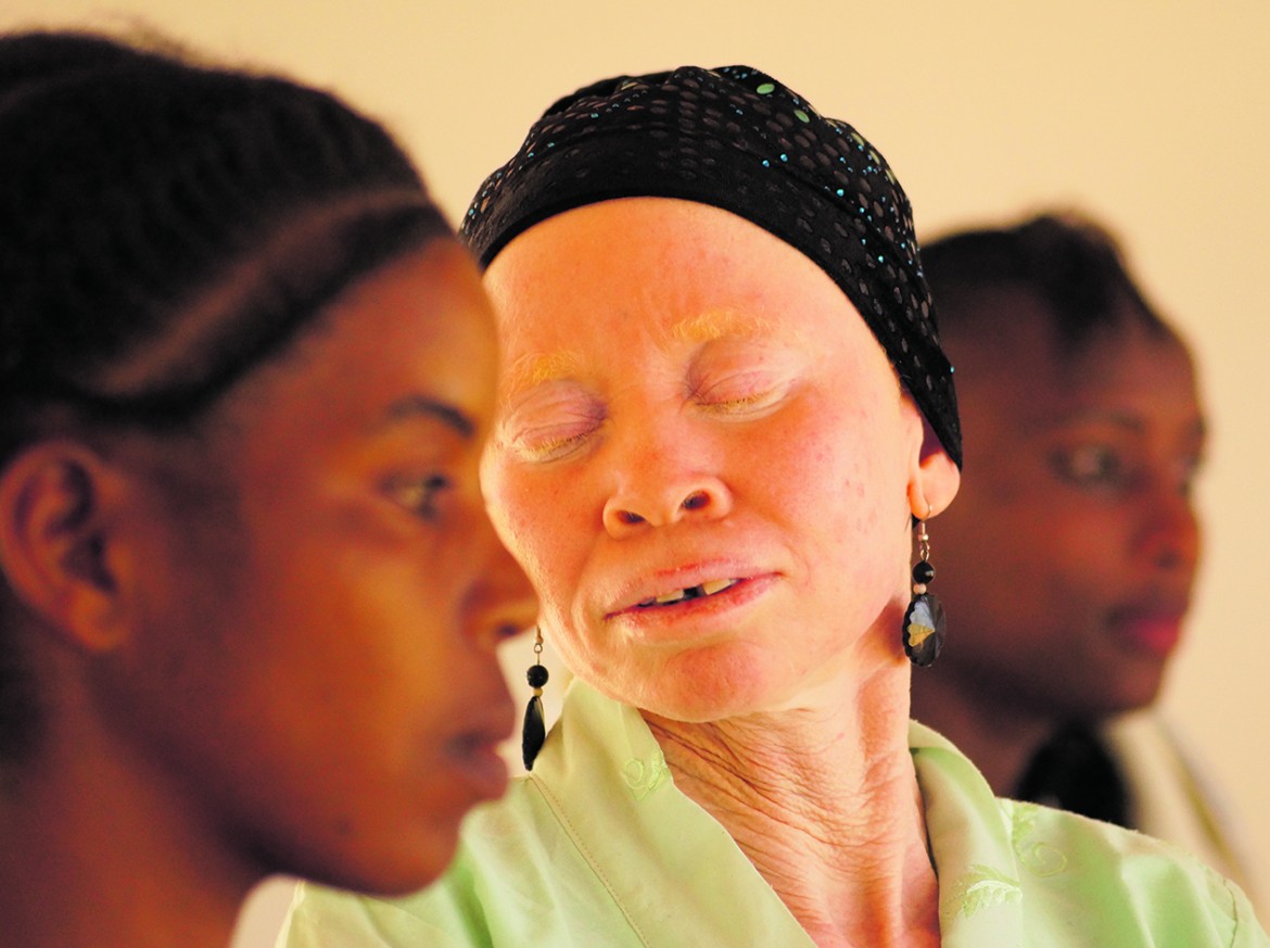 Albino pride, il potere bianco dell’Africa
