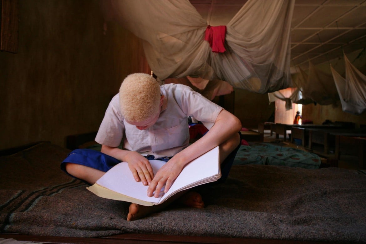 Liberismo e stregoneria, in Tanzania albini senza pace